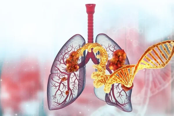 Clash Of Drugs Impedes Lung Cancer Treatment, Lowers Survival